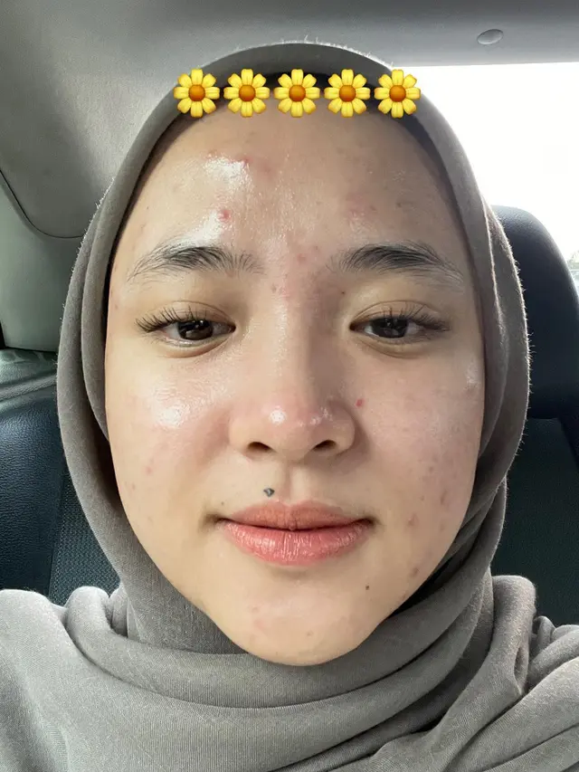 Nissa Sabyan Tanpa Makeup