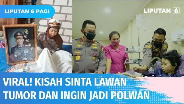 Kisah pilu bocah yang bercita-cita jadi Polwan, namun terhambat karena menderita tumor di kaki didengar Kapolri. Jenderal Listyo Sigit kirimkan helikopter untuk jemput dan bawa Sinta berobat di Jakarta.