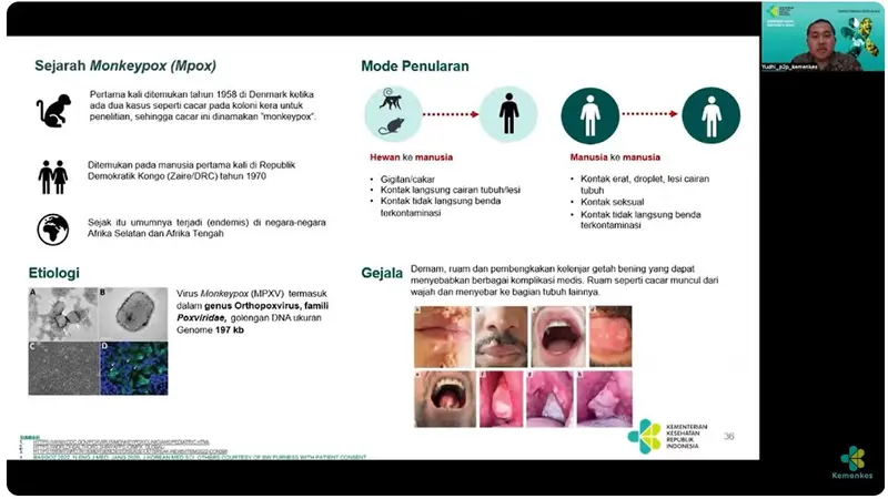 Virus Mpox Mewabah! Ini Gejala dan Cara Penularannya yang Harus Diwaspadai (Tangkapan Layar dari Temu Media : Update Mpox di Indonesia/Youtube Kemenkes RI)