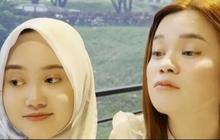 Menghilang Bak Ditelan Bumi, Intip Penampilan Terbaru Sinta Keong Racun yang Makin Cantik Bak Idol K-Pop di Usia 33 Tahun