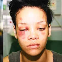 Rihanna menjadi korban kekerasan fisik yang dilakukan oleh mantan kekasihnya Chris Brown. Foto-foto Rihanna dengan wajah memar dan bengkak pun tersebar di internet. (Destination Femme)