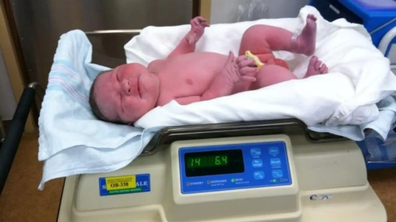 Buat Takjub, Bayi Baru Lahir Ini Punya Bobot 6,5 Kg