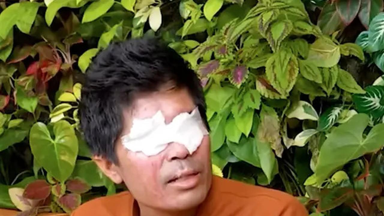 Uang Donasi Agus Salim Akhirnya Didonasikan untuk Korban Bencana Alam di Lewotobi, Ini Fakta di Baliknya