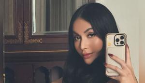 Denada Jalani Oplas. (Foto: Instagram/denadaindonesia)