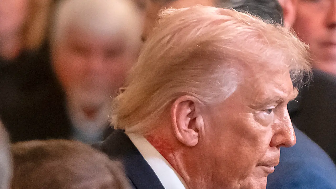 Ruam merah pada leher Donald Trump jadi sorotan. (Foto: AP Photo/Mark Schiefelbein)