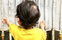 Ini Alasan Kenapa Anak di Desa Lebih Jarang Terinfeksi ISPA Dibanding Anak di Kota