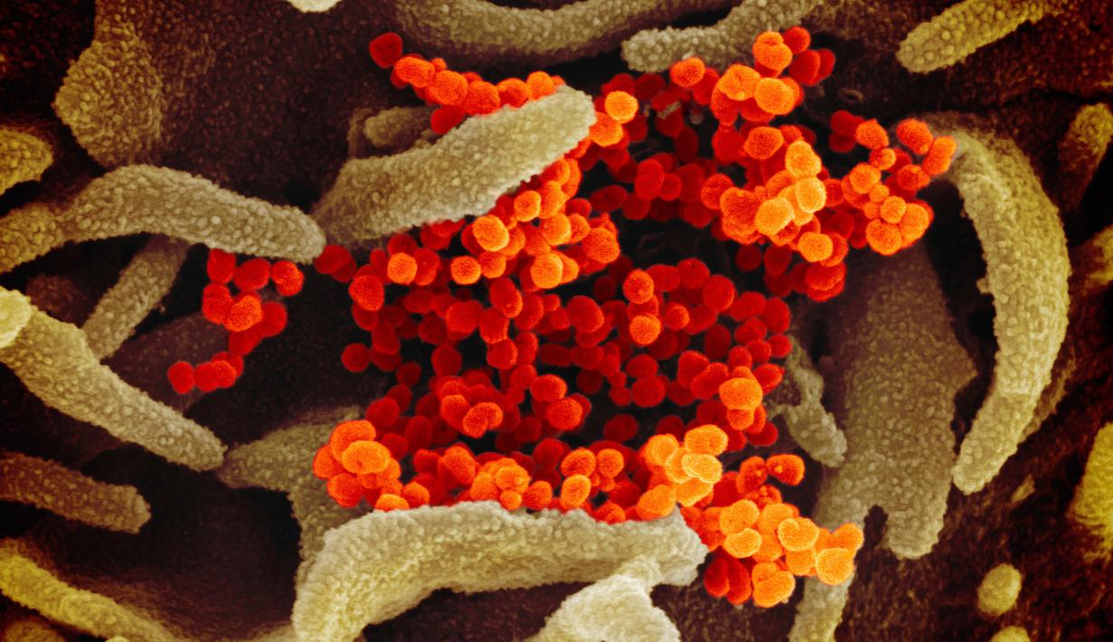 Foto Penampakan Virus Corona Covid 19 Dilihat Dari Mikroskop