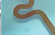 Kasus Pertama di Dunia, Cacing Hidup Berukuran 8 Cm Ditemukan dalam Otak Perempuan Australia