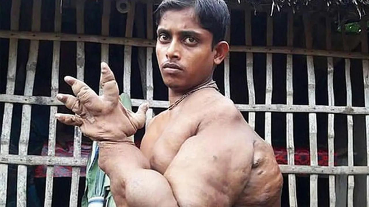 Penyakit Misterius