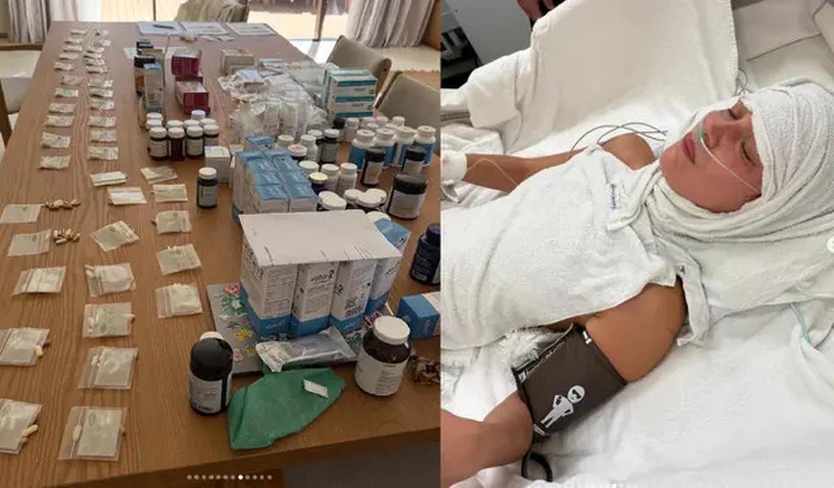 Potret Bella Hadid Berjuang Lawan Penyakit Lyme, Obat-obatannya Semeja Penuh