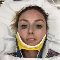 Cerita unik datang dari seorang cewek yang langsung melakukan review eyeliner setelah kecelakaan. Padahal wajahnya masih berdarah-darah lho. (Foto: Shelby Pagan)