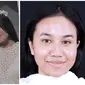 Mayang kini tampil lebih glow up usai perawatan wajah. (Sumber: Instagram/mayang.soedrajat/dermaprosf)