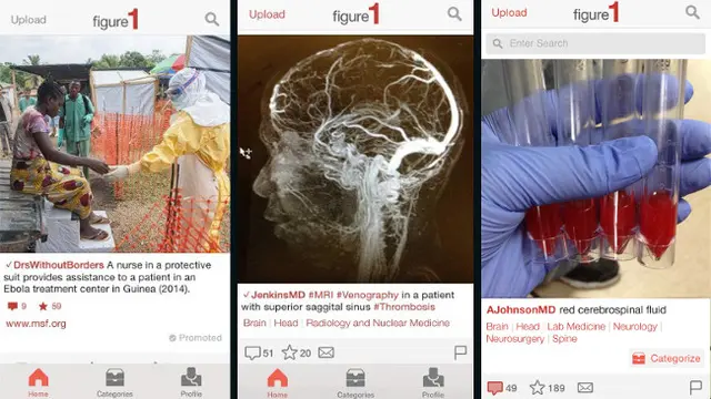 'Instagram' Khusus Dokter, Situs Berbagi Misteri Medis