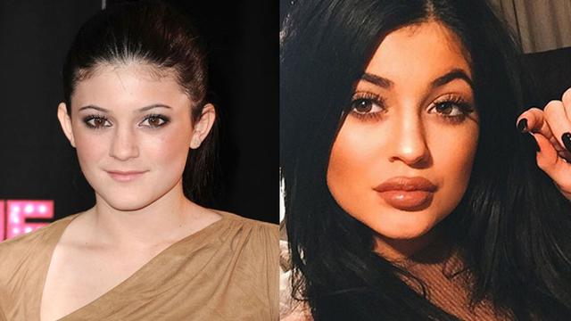 Transformasi Wajah Kylie Jenner Dulu Hingga Kini Tanpa Operasi