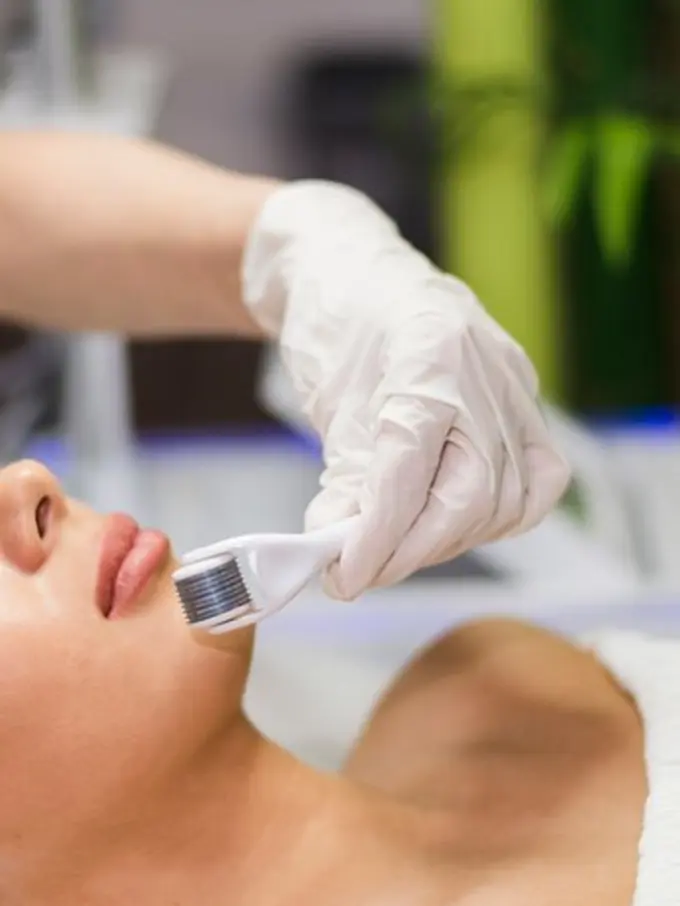 Seorang perempuan sedang mendapatkan perawatan kulit menggunakan dermaroller (Foto Dok: Freepik/freepik)