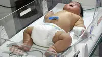 Bayi terbesar di India yang terlahir berbobot sekitar 6 kg. (Yahoo News)