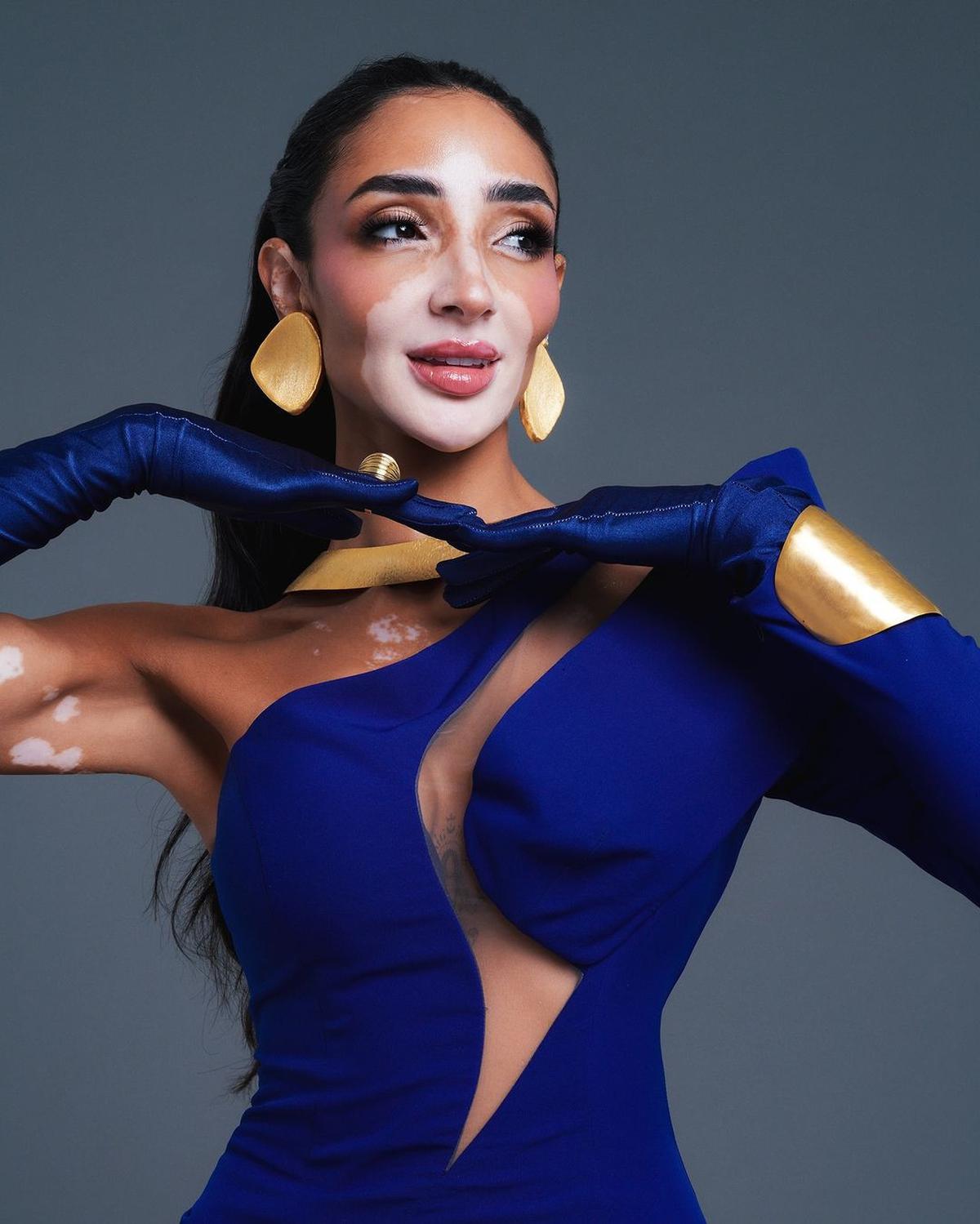 Profil Logina Salah, Miss Universe Mesir 2024 yang Buktikan Vitiligo Bukan Penghalang
