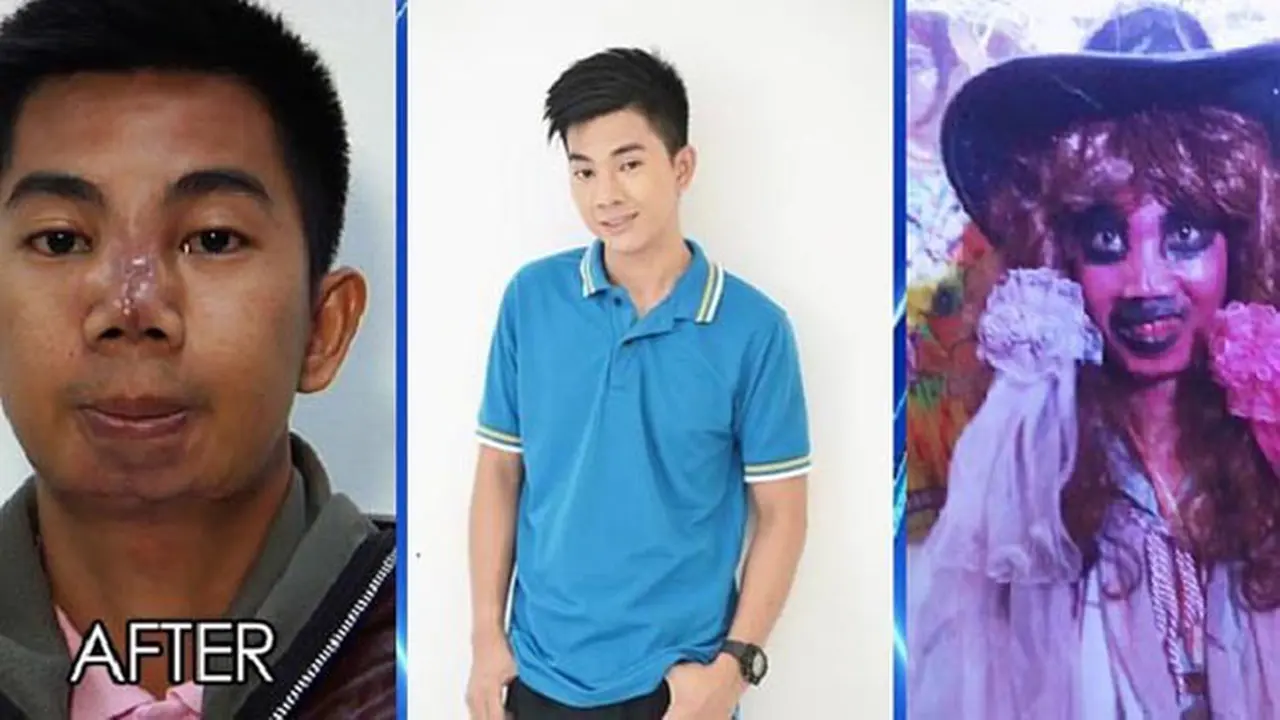 Gagal Oplas, Model Ganteng Beralih Profesi Jadi Badut