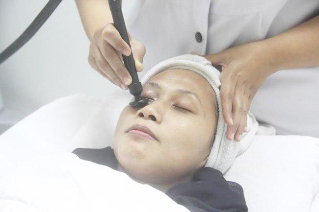 Treatment untuk menghilangkan lingkar hitam pada mata | foto: copyright vemale/yuni
