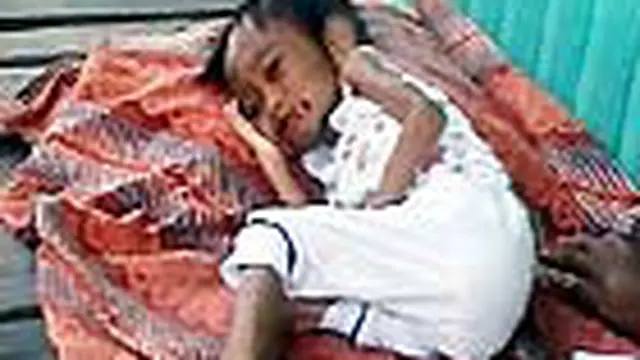 Seorang bocah yatim piatu di Palangkaraya, Kalteng, menderita gizi buruk. Tak hanya sangat kurus, di tubuh bocah tiga tahun itu juga terdapat sejumlah luka akibat sanitasi yang buruk.