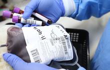 6 Fakta Golongan Darah A Wanita yang Jarang Diketahui, Rentan Penyakit Diabetes hingga Kanker