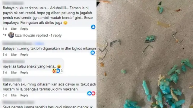 Lidah Bocah Tertusuk Isi Staples