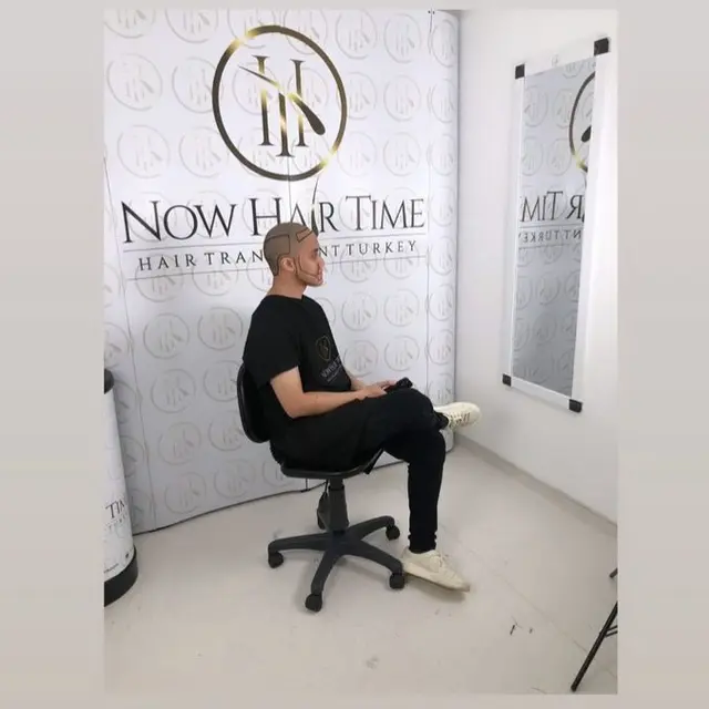 Potret Kevin Aprilio Jalani Transplantasi Rambut. (Sumber: Instagram/kevinaprilio)