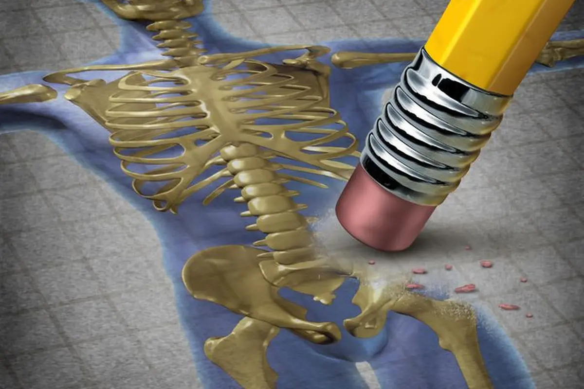 Osteoporosis