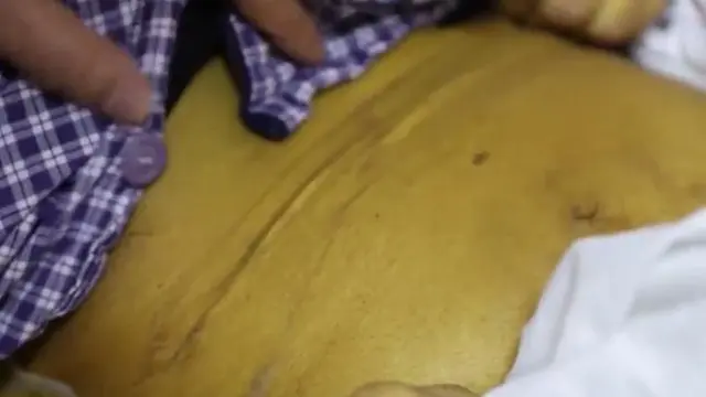 Merokok Tiap Hari Selama 30 Tahun, Tubuh Pria Ini Berubah Menguning