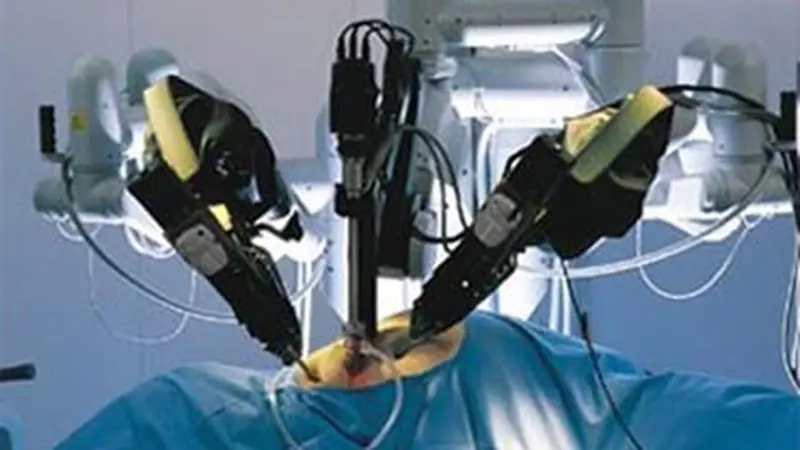 Robotic Surgery Tetap Mengandalkan Keahlian si Dokter Bedah