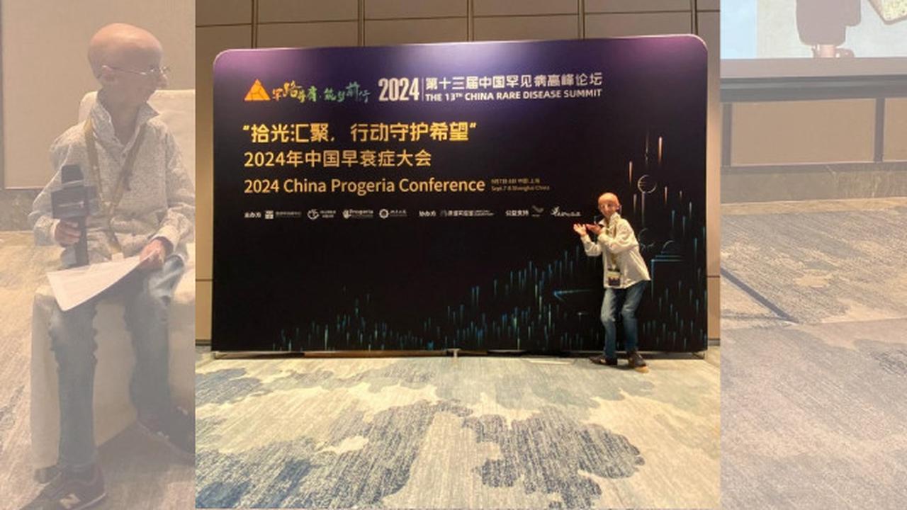 Dengan semangat tak kenal lelah, Sammy Basso menghadapi progeria hingga akhir hayatnya. Kematian pada usia 28 meninggalkan warisan inspirasi bagi banyak orang di seluruh dunia. (Foto: instagram.com/sammybasso)