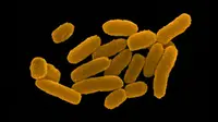 Bakteri Y. Pestis penyebab pandemi Black Death dan Great Plague (Dennis Kunkel Microscospy, Inc., Visual Unlimited, Corbis)