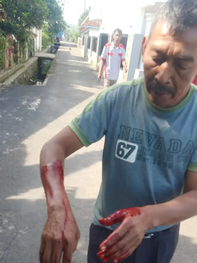 Suripto (58 tahun), salah satu korban serangan monyet liar di Desa Wanakerta, Kecamatan Cibatu, Garut, Jawa Barat, mengalami luka di bagian tangan sebelah kanan. (Liputan6.com/Jayadi Supriadin)