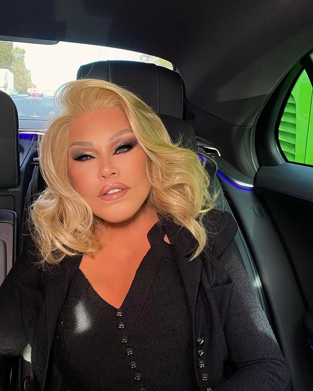 Jocelyn Wildenstein, Perempuan Berjuluk Catwoman Meninggal Dunia