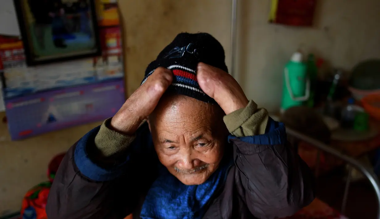 Penderita kusta Nguyen Quang Chieu duduk di ranjang kompleks RS Van Mon Leprosy, Thai Binh, Vietnam, Minggu (20/1). RS Van Mon Leprosy merupakan rumah sakit khusus kusta tertua di Vietnam. (Manan Vatsyayana/AFP)