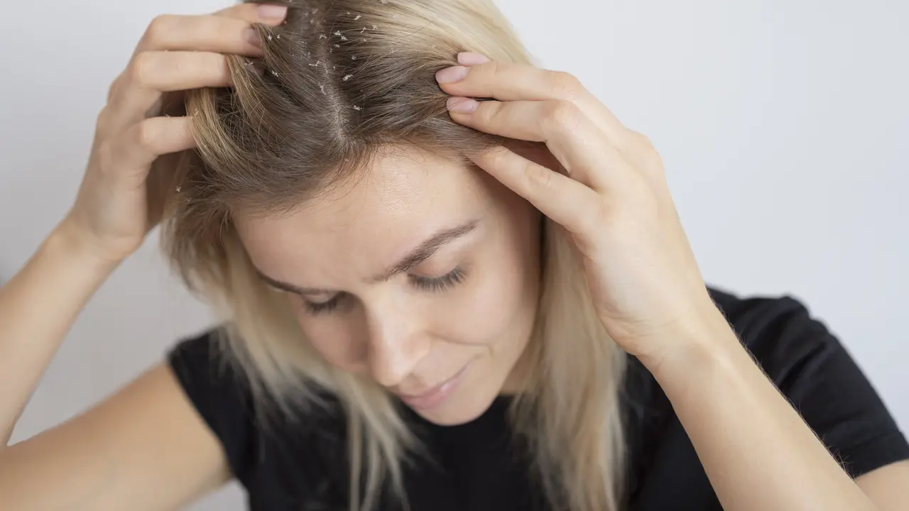 6 Tips Mengatasi Rambut Rontok dan Berketombe (photo by freepik.com)