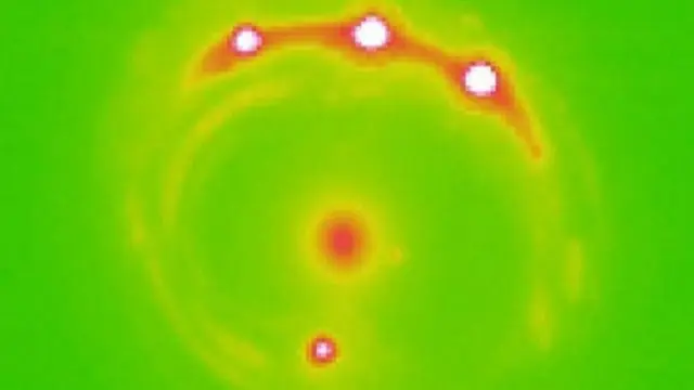 Microlensing