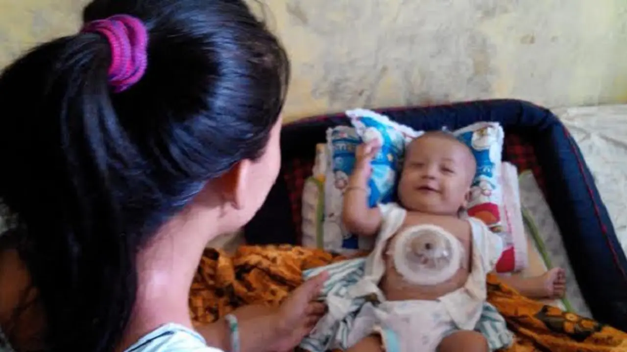 20160311-Bayi jantung luar