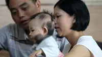 Bayi Perempuan Lahir dengan 50 Persen Tanda Lahir di Tubuhnya