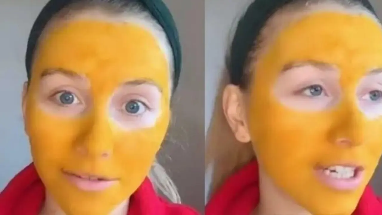Niat Bikin Glowing, Wajah Gadis Ini Jadi Kuning Usai Pakai Masker Kunyit