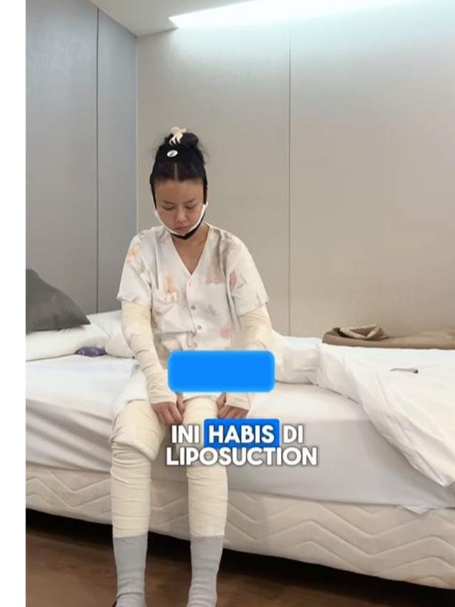 6 Potret Nita Gunawan Jalani Operasi Transfer Lemak ke Wajah Usai BB Turun 10 Kg