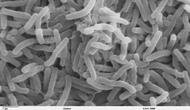 Bakteri kolera (Vibrio cholerae) tampak mikroskopis (Wikimedia / Creative Commons)
