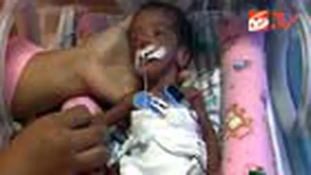 Bayi Prematur Ditelantarkan Orangtua