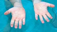 Jari-jari yang keriput karena berada lama terkena air menandakan tangan atau kaki siap berpegangan pada benda-benda basah. (Foto: iStockphoto)