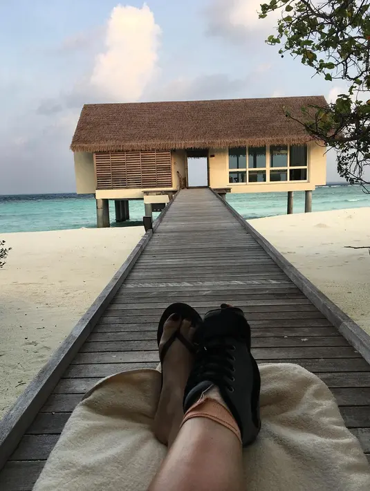 Beberapa jam usai Justin Bieber menunggah foto, Pattie pun ikut mengunggah keadaan kakinya lewat akun Instagram. (instagram/pattiemallete)