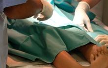 Berapa Usia Terbaik untuk Anak Laki-Laki Sunat? Ini Penjelasan Dokter