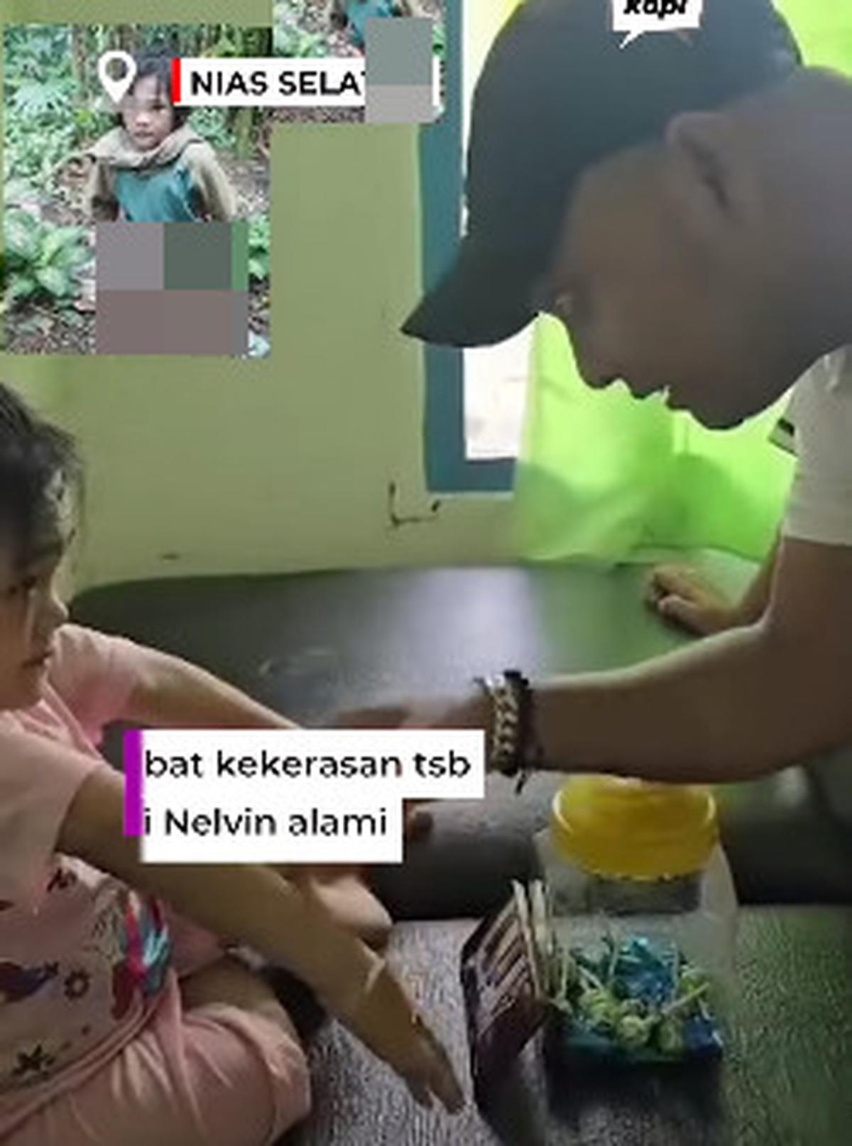 Potret Pilu Bocah Yatim Alami Cacat Fisik hingga Kaki Bengkok