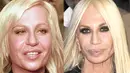 Donatella Versace adalah seorang perancang busana terkenal. Ia menjalani berbagai oplas untuk menjadikannya cantik seperti model-model yang mengenakan pakaian rancangannya. Hasilnya tak sesuai harapan.(Istimewa)