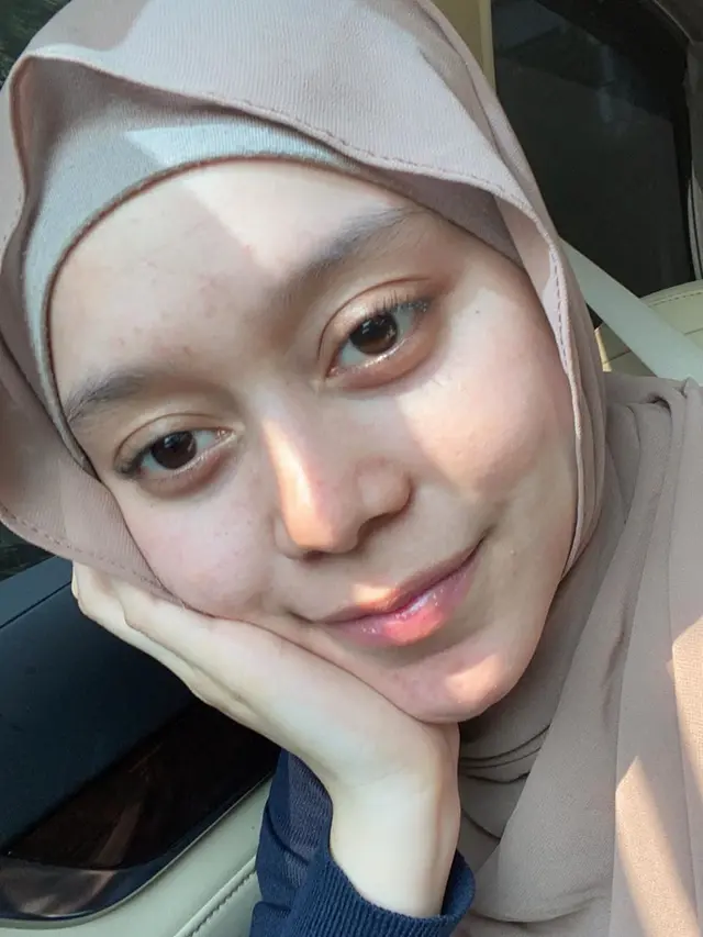 Disebut Berjerawat, Ini 6 Potret Lesty Kejora Tanpa Makeup