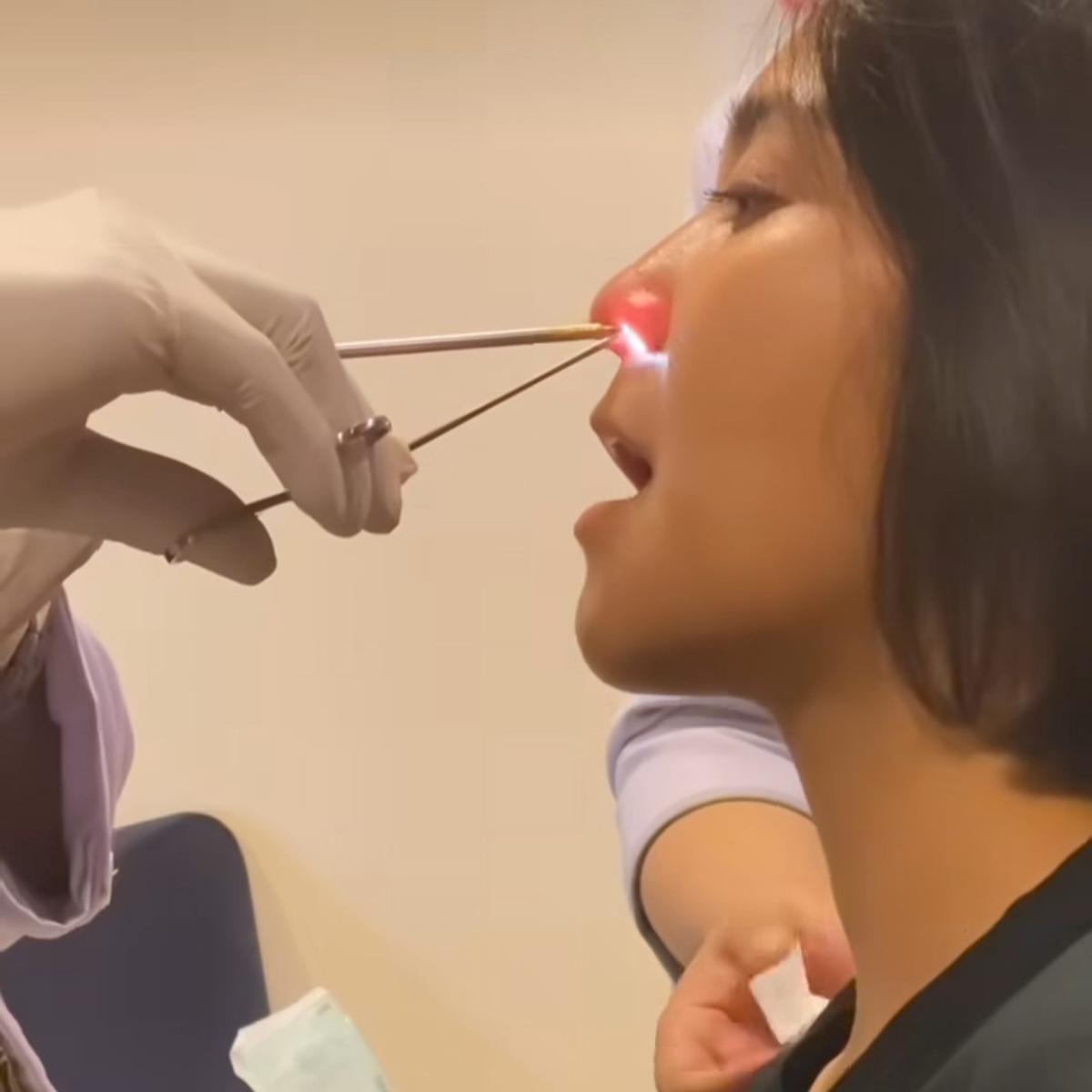Caca Tengker Tiap Bulan Masuk Rumah Sakit, Idap Covid, Sinusitis Hingga Operasi Kantung Empedu